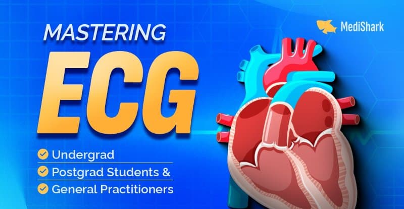 Mastering ECG